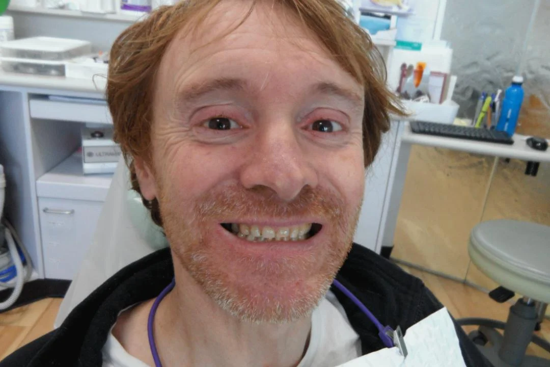 Stephen before after dental treatment