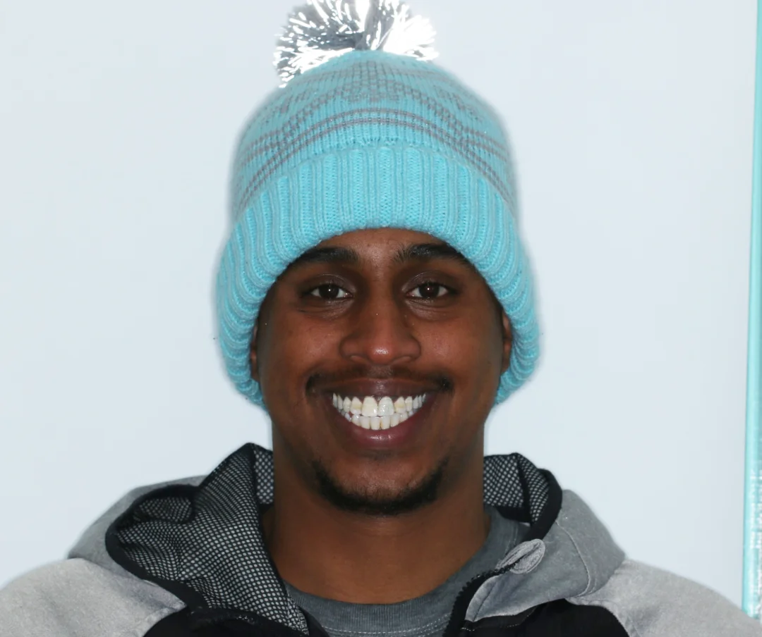 Abshir before after dental treatment