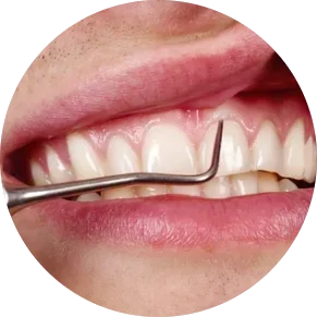 Why treat gum disease — Dentists of Ivanhoe