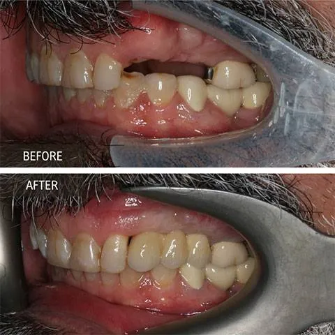 DOI---Implants-2