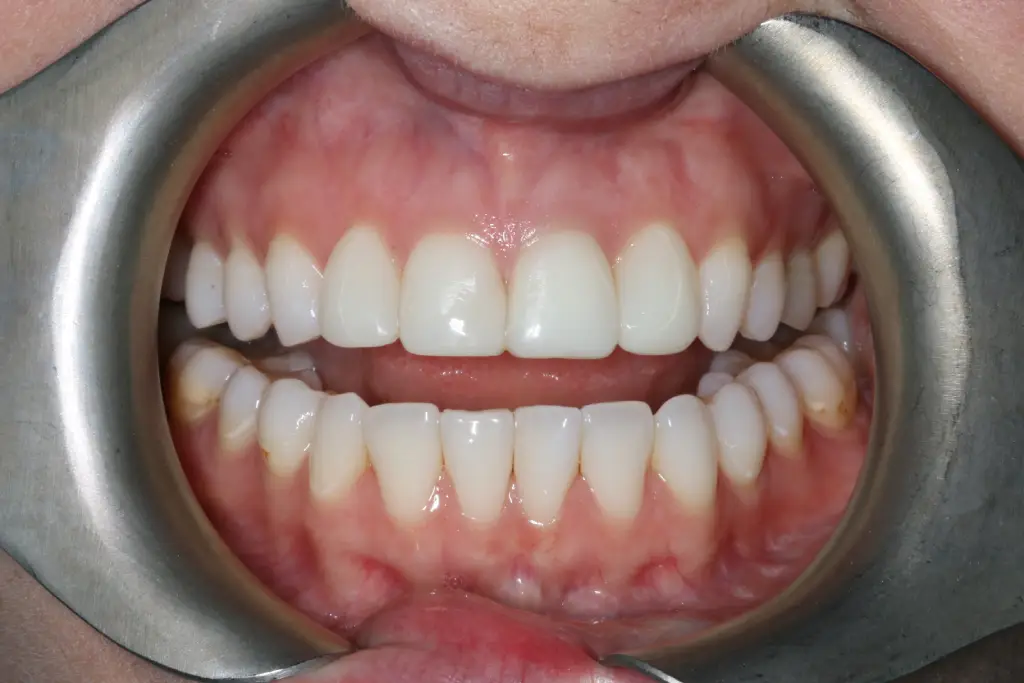 Sophie before after dental treatment