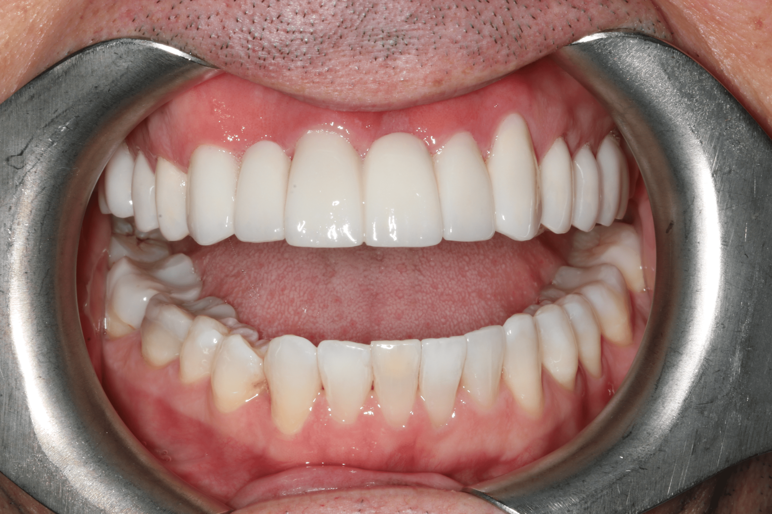 Daniel before after dental treatment