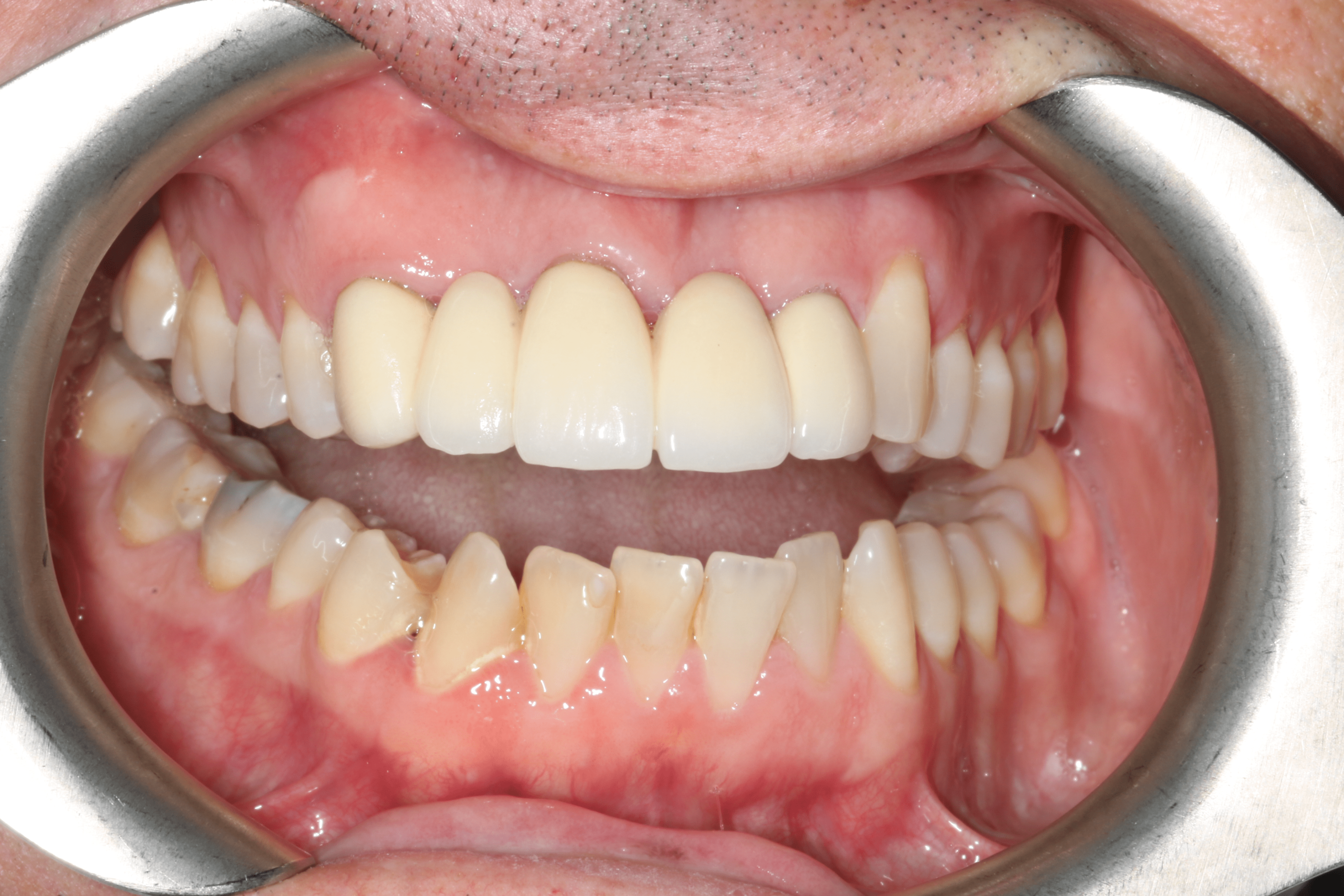 Daniel before after dental treatment