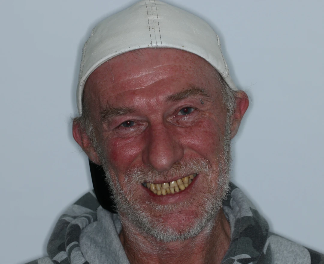 Jamie before after dental treatment