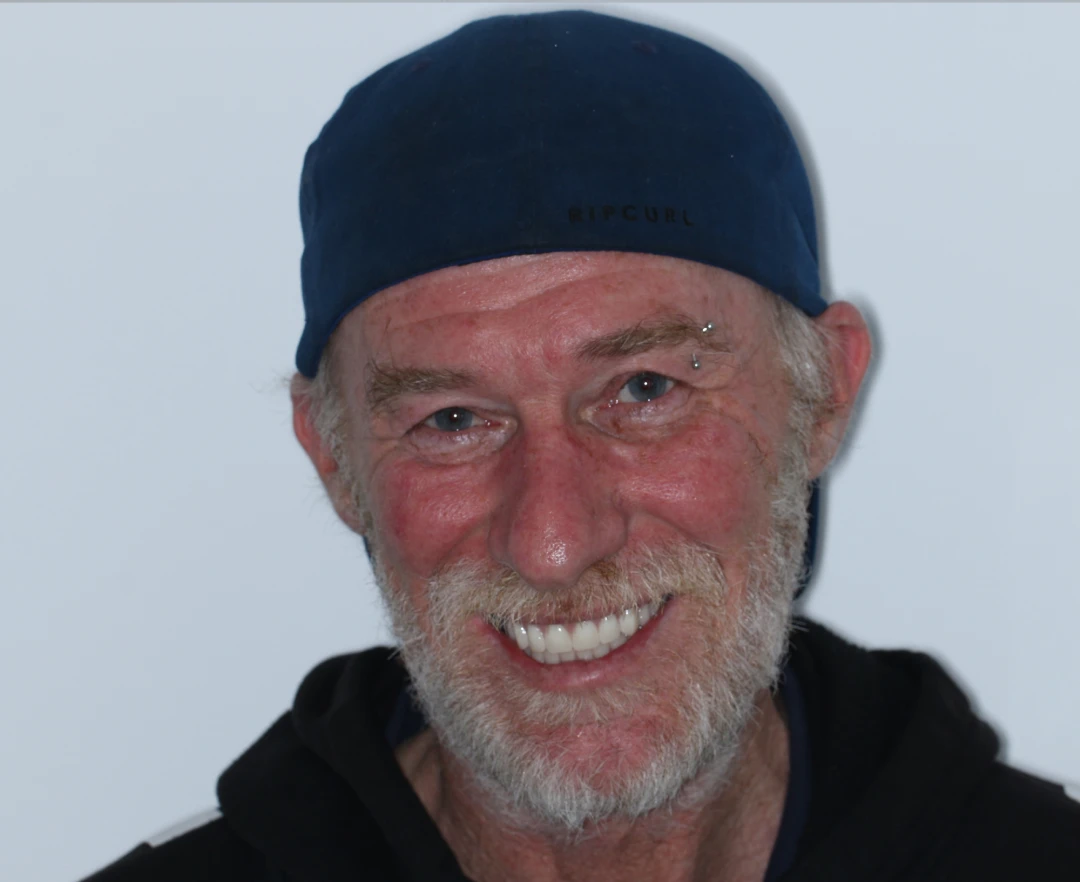 Jamie before after dental treatment