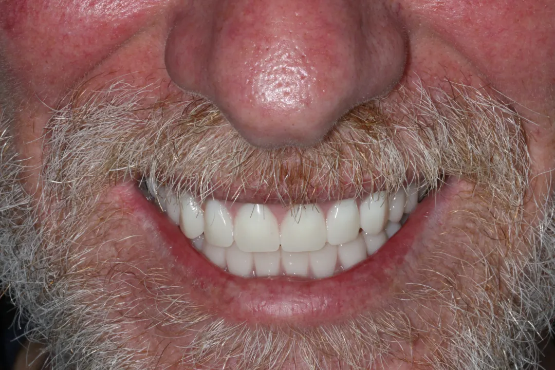 Jamie before after dental treatment