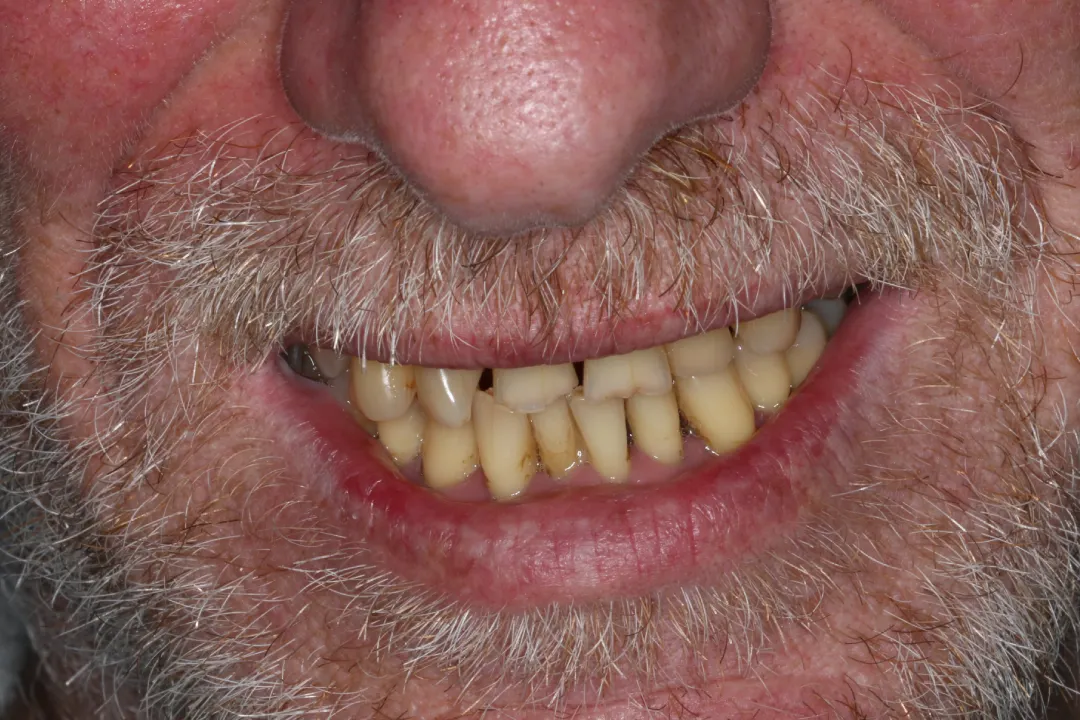 Jamie before after dental treatment