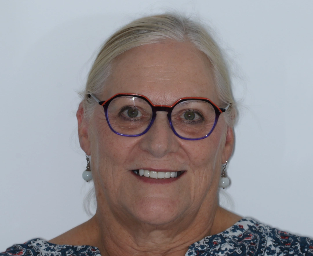 Naomi before after dental treatment