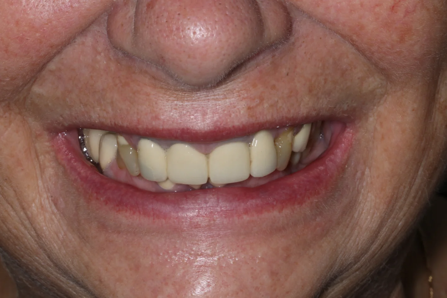 Stella before after dental treatment