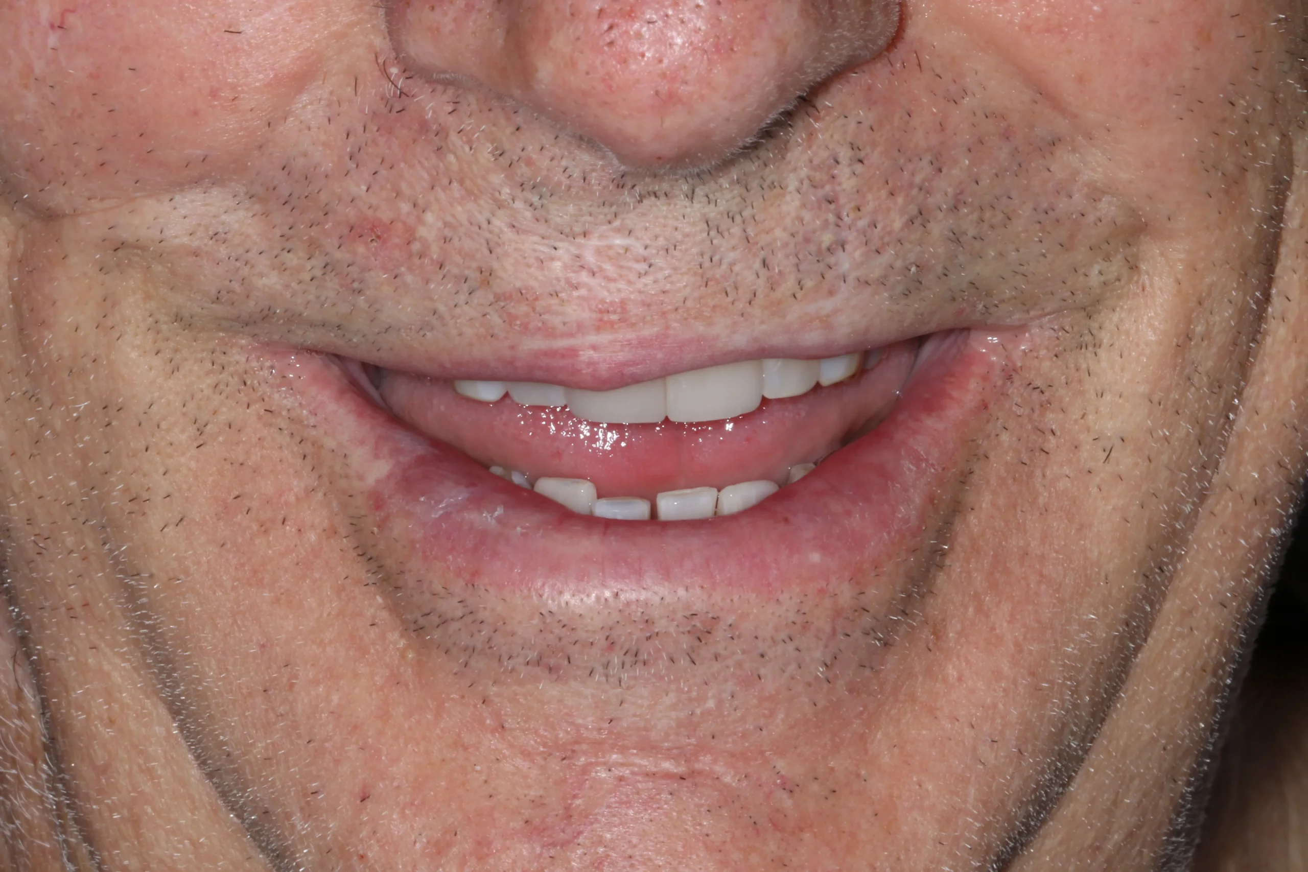 Jim before after dental treatment