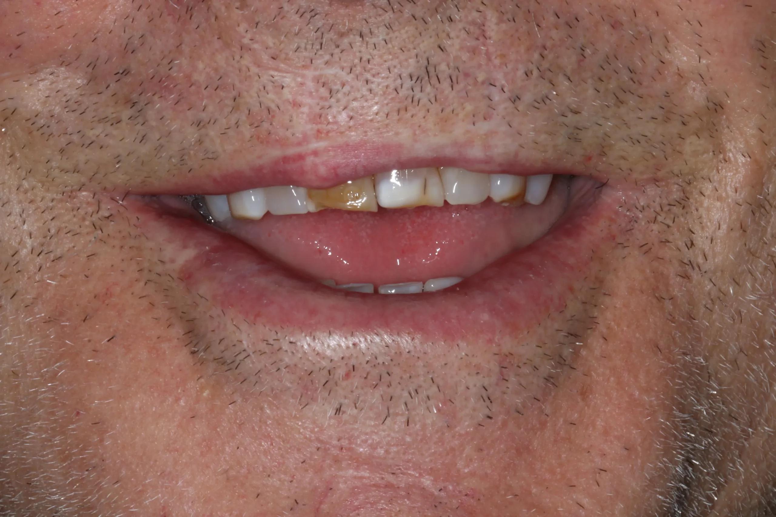 Jim before after dental treatment