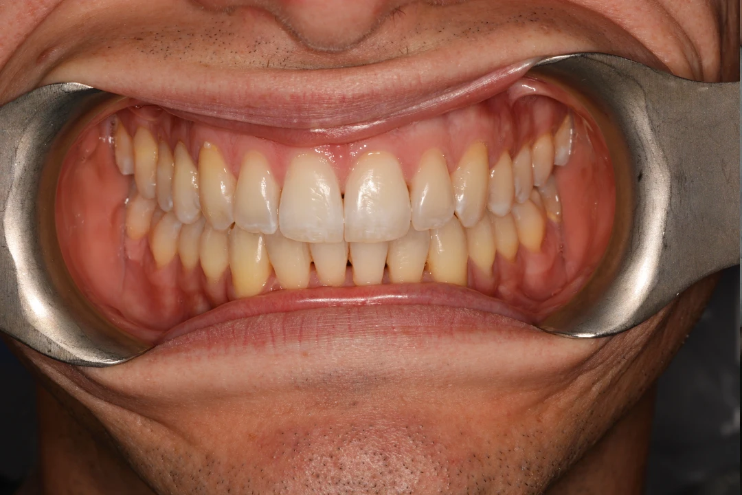 Brad before after dental treatment