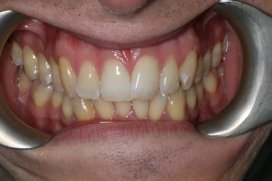 Brad before after dental treatment