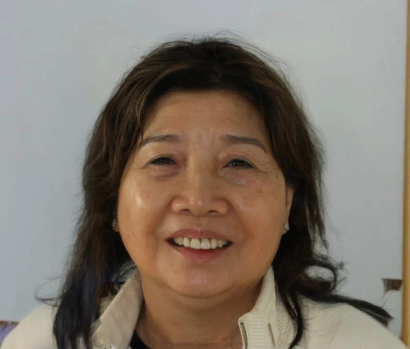 Sew Chin before after dental treatment