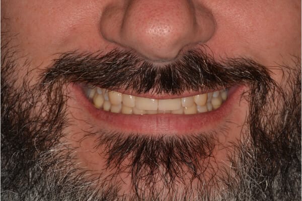 David before after dental treatment