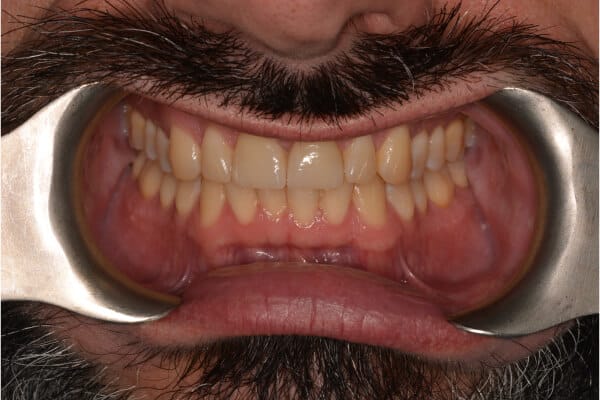 David before after dental treatment