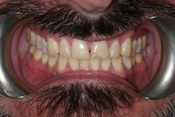 David before after dental treatment