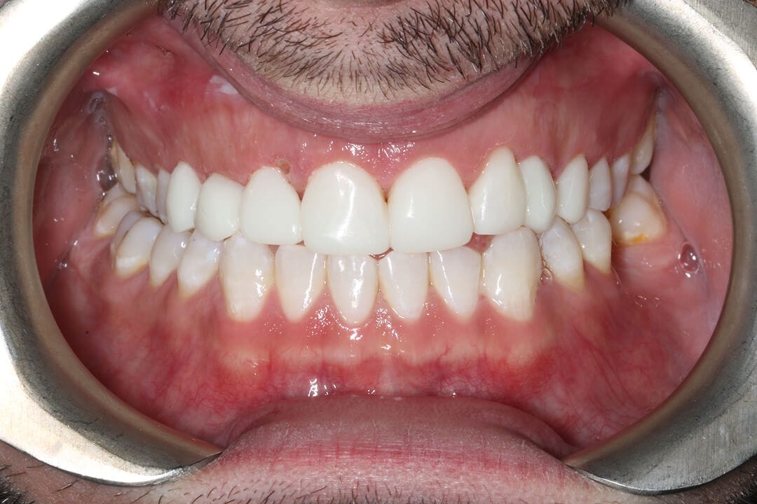 Christian before after dental treatment