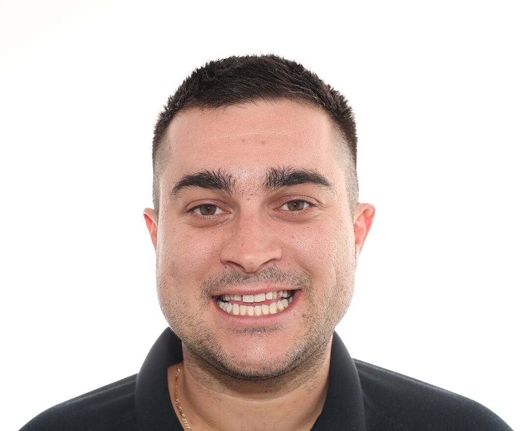 Christian before after dental treatment