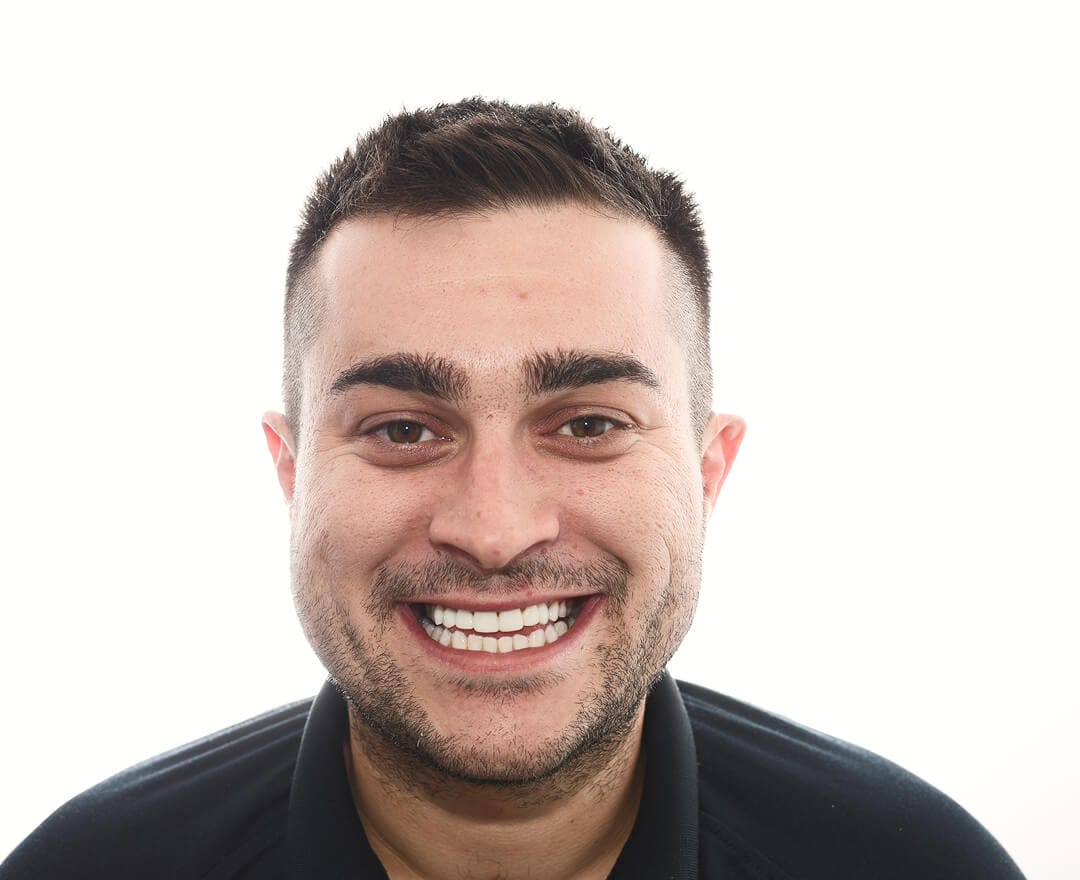 Christian before after dental treatment