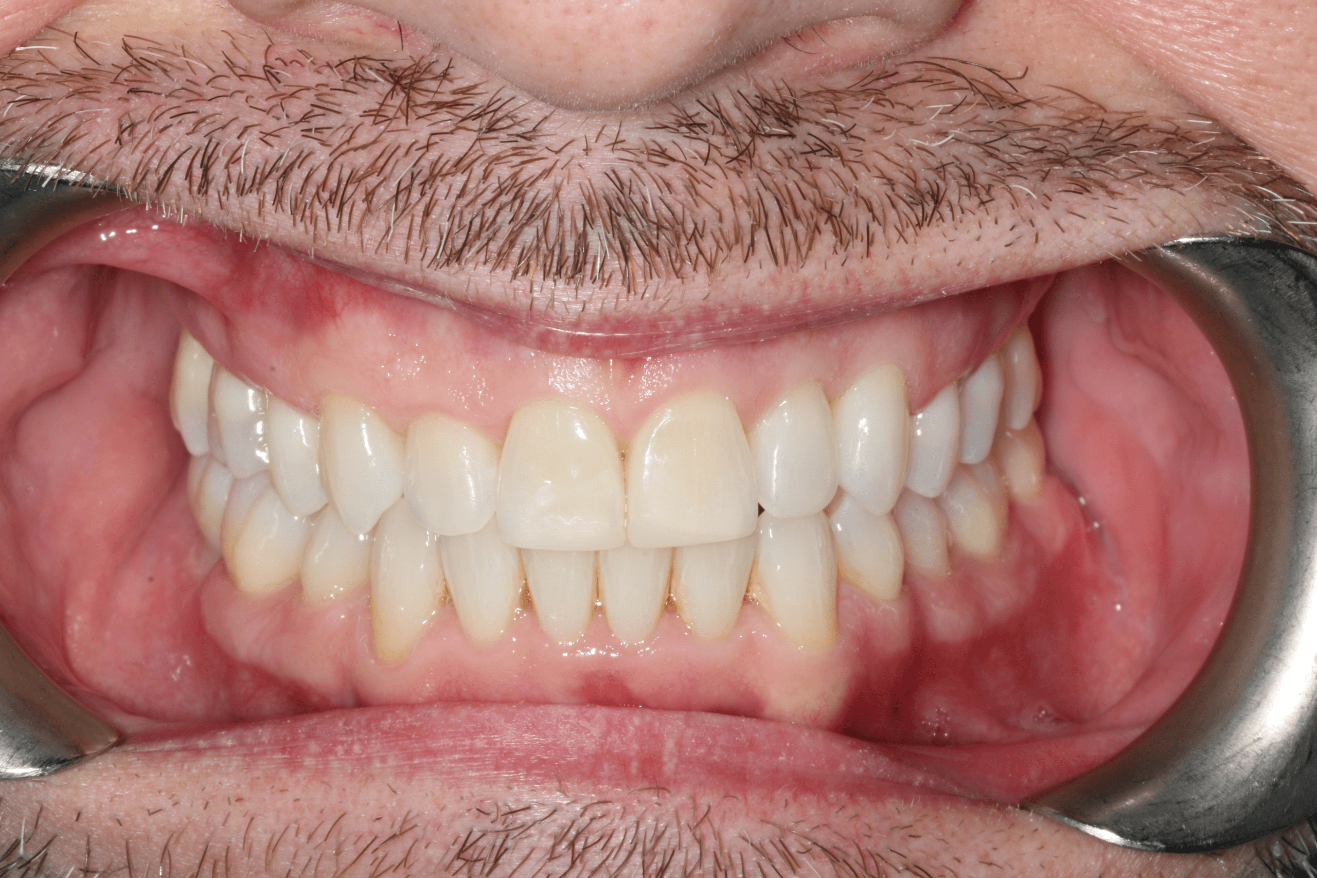 Olly before after dental treatment