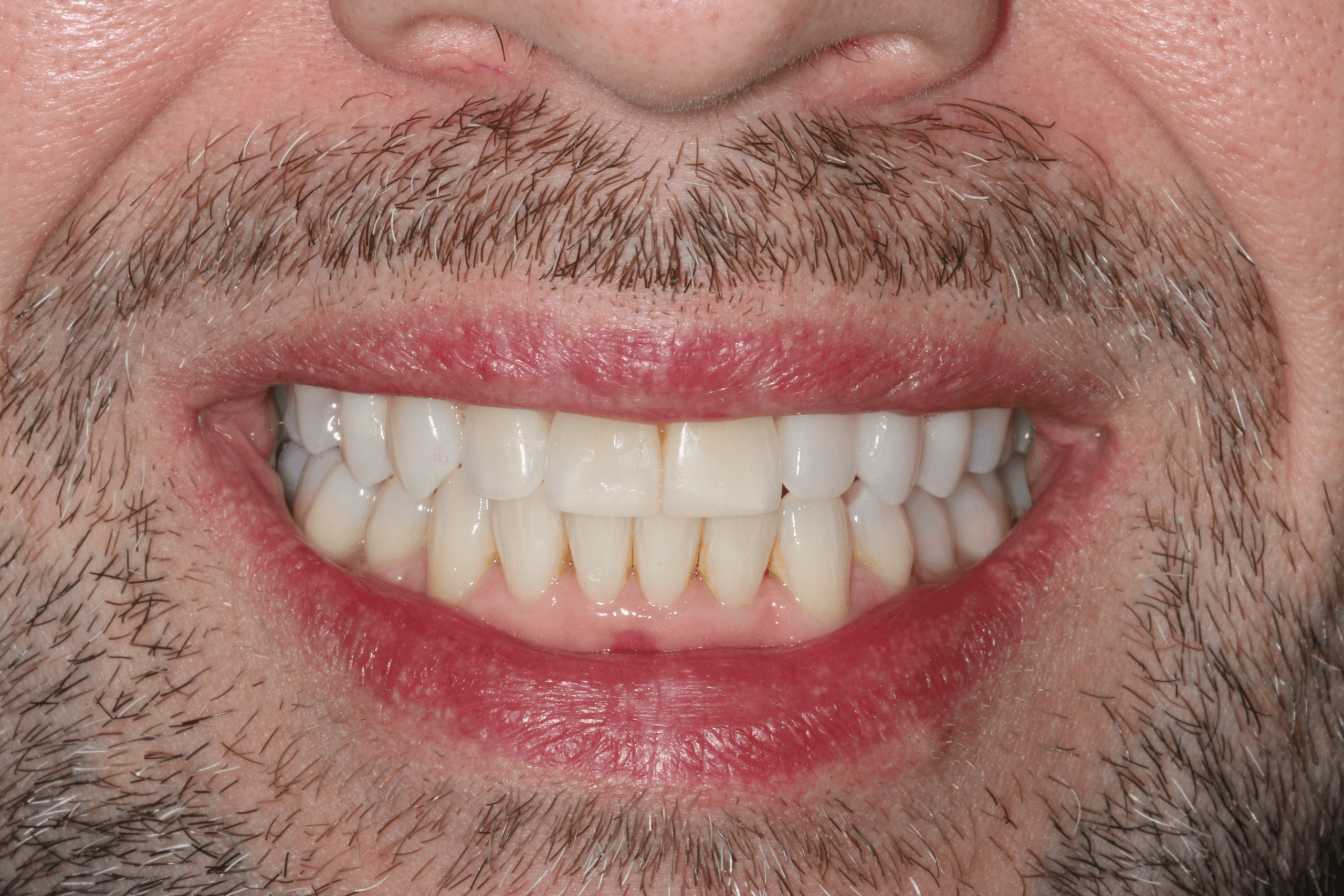 Olly before after dental treatment