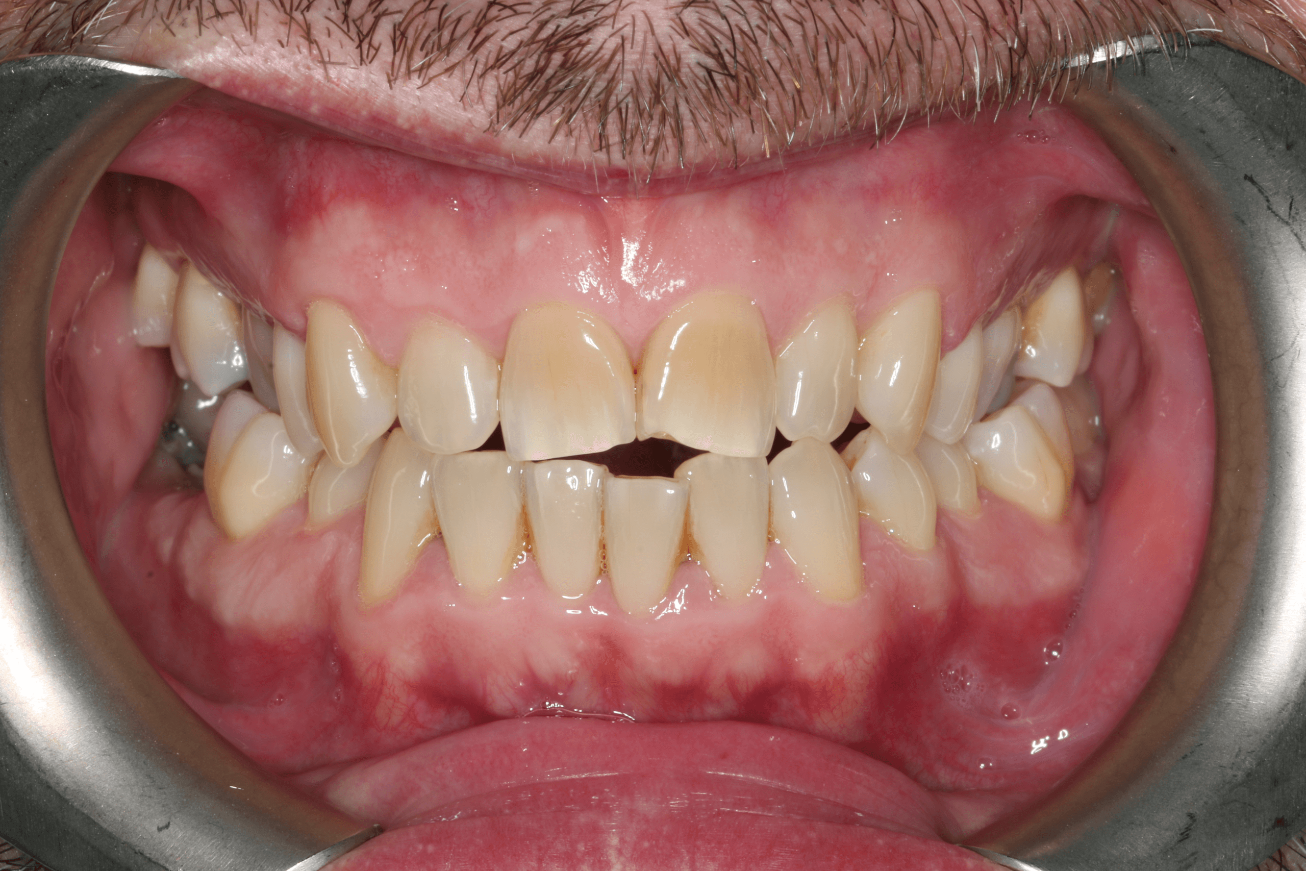 Olly before after dental treatment