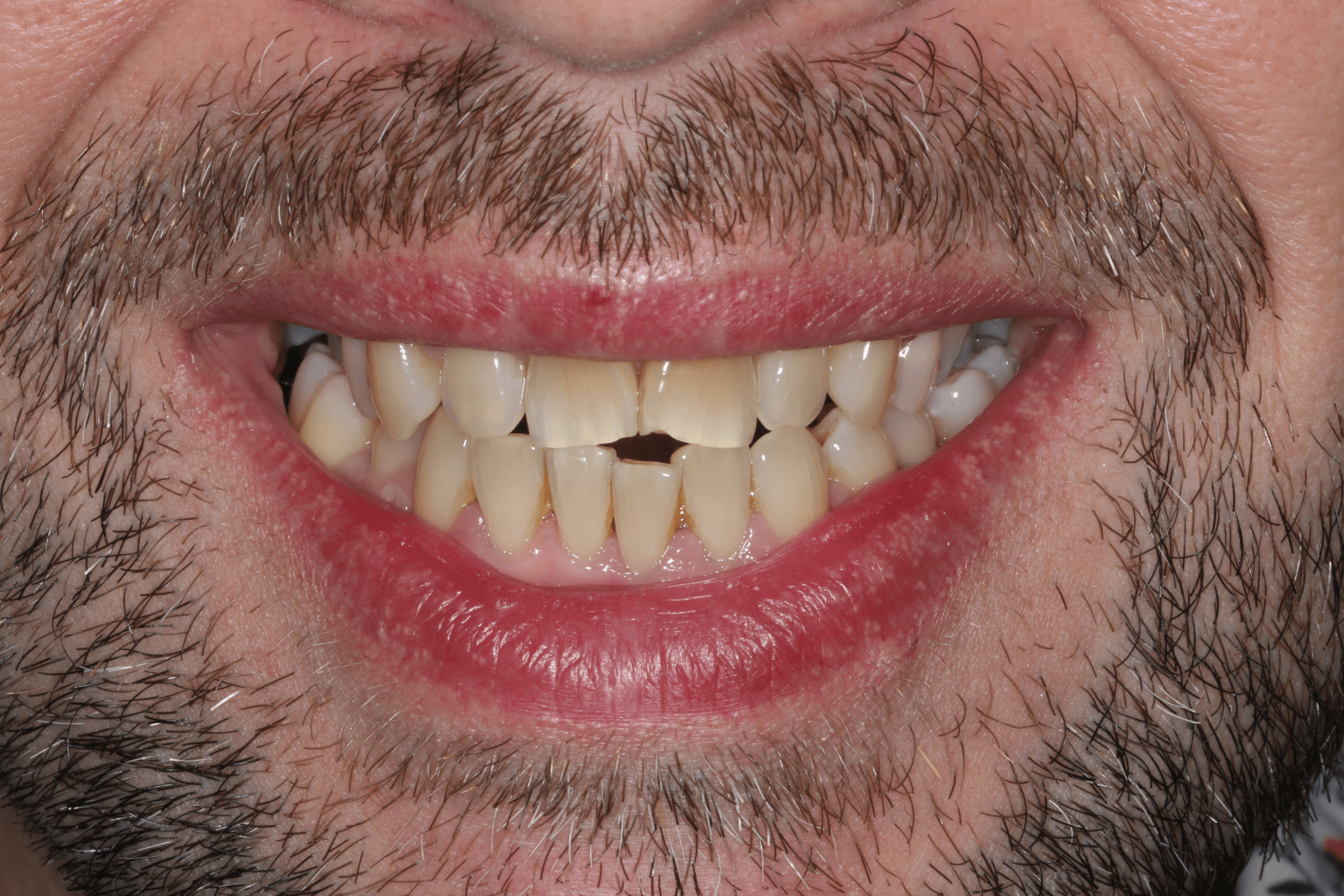 Olly before after dental treatment