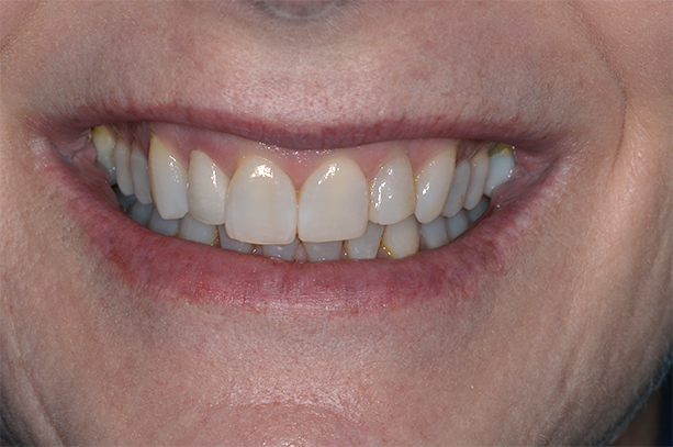  Cate before after dental treatment