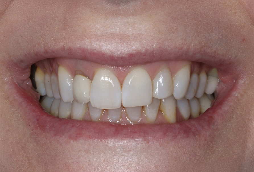  Cate before after dental treatment