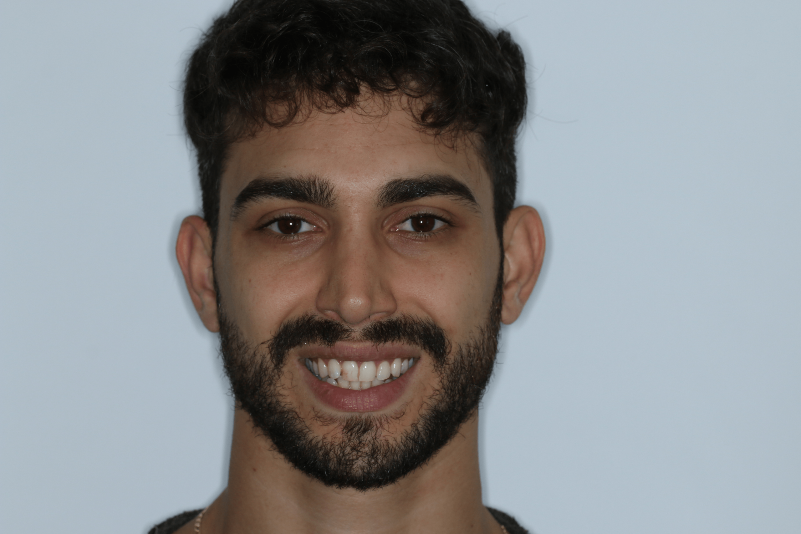 Tamir before after dental treatment