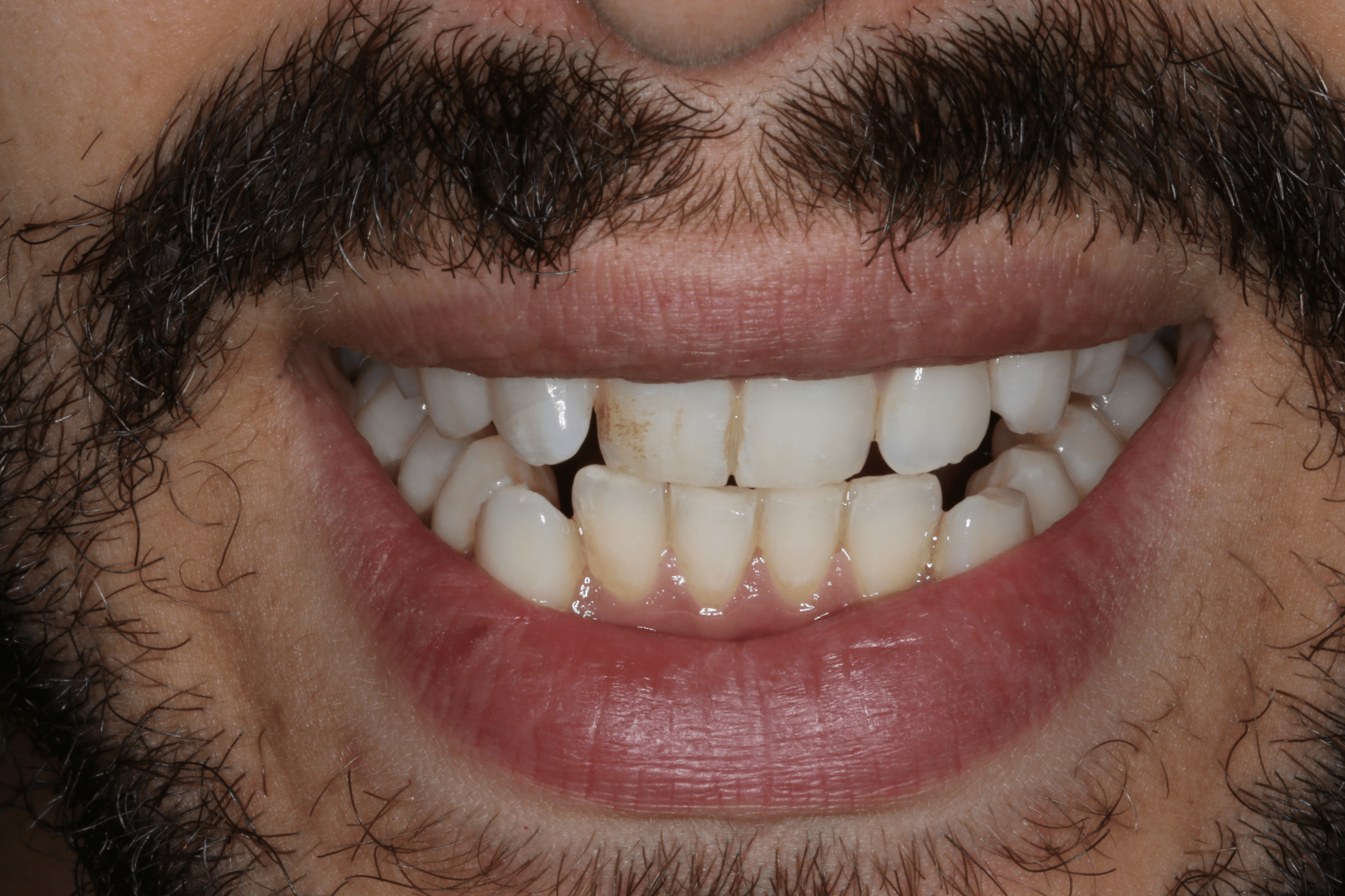 Tamir before after dental treatment