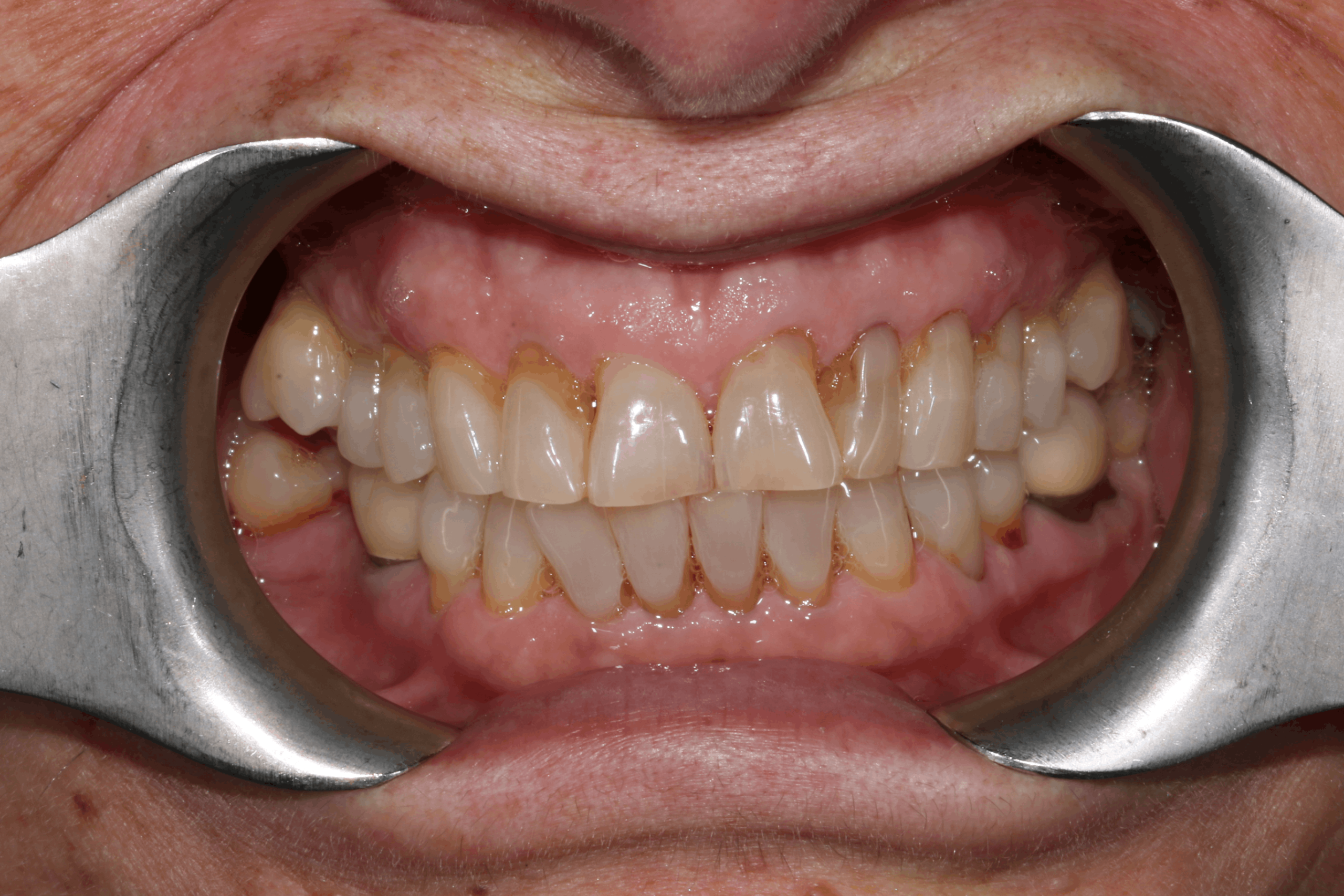 Isabelle before after dental treatment