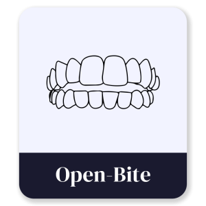 1_Open-Bite