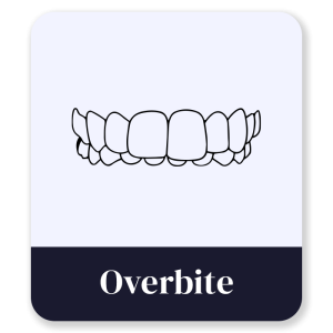 2_Overbite