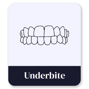 3_Underbite