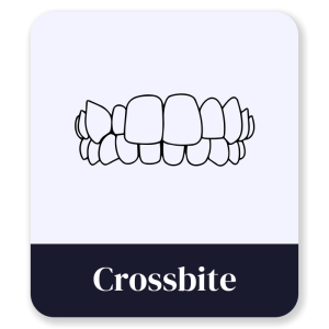 4_Crossbite