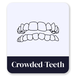 5_Crowded-Teeth