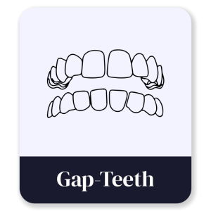 6_Gap-Teeth